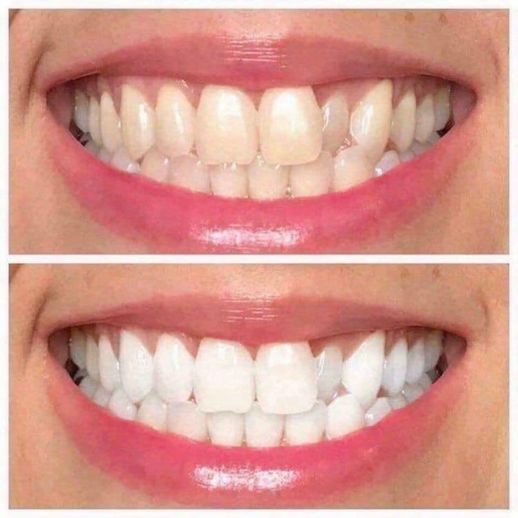 AP24 whitening toothpaste - Picture 3 of 7